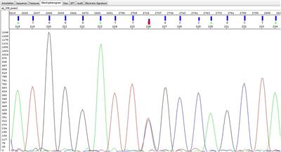 Genetic Screening of Mutations Associated with Fabry Disease in a Nationwide Cohort of Juvenile Idiopathic Arthritis Patients